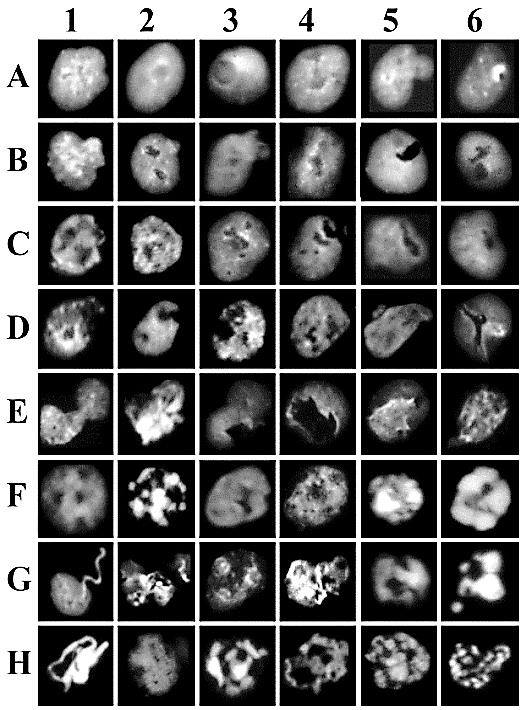 chromatin condensation